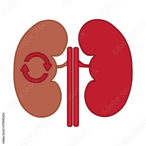 kidney transplant 