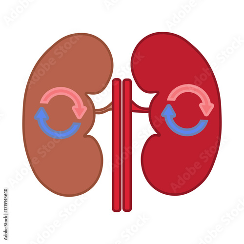 kidney transplant 