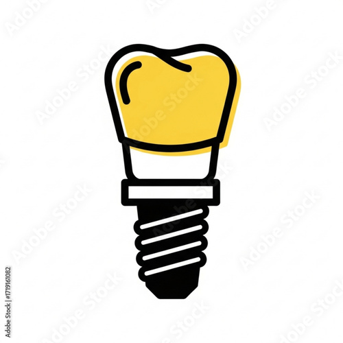 Illustration of a dental implant