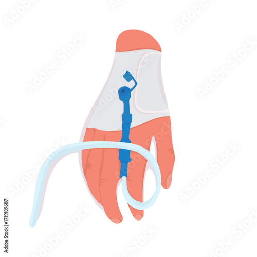 hand vector with IV line