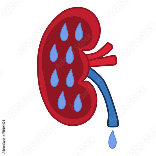 Diabetic Nephropathy
