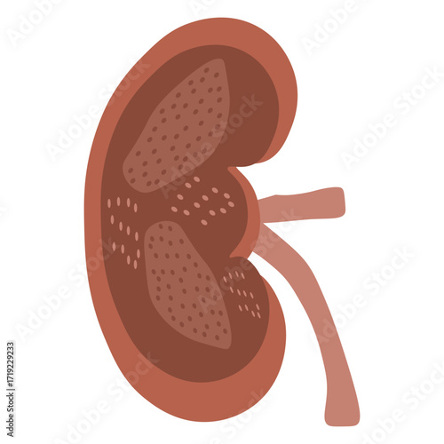 chronic kidney disease