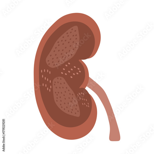 chronic kidney disease