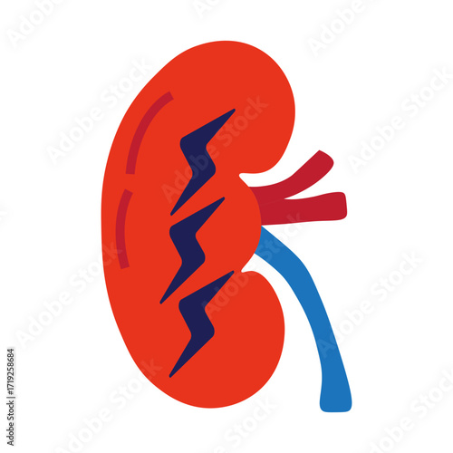 Acute Kidney Injury