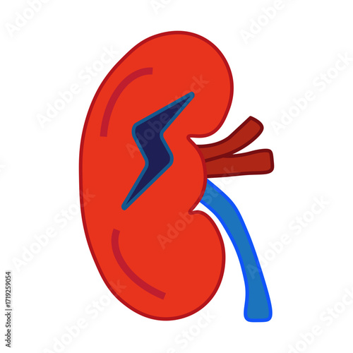 Acute Kidney Injury