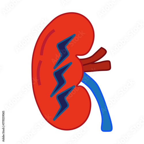 Acute Kidney Injury