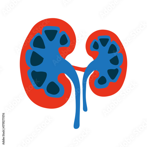 Hydronephrosis