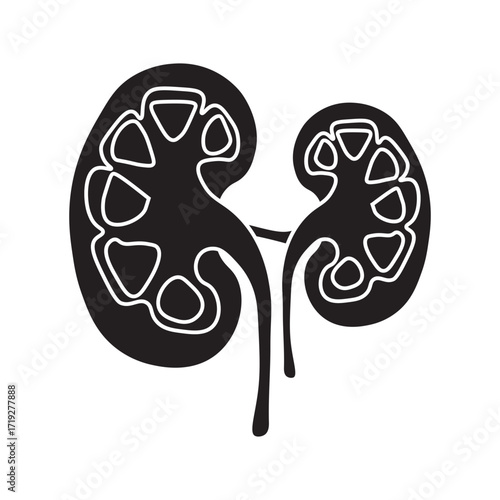 Hydronephrosis line icon