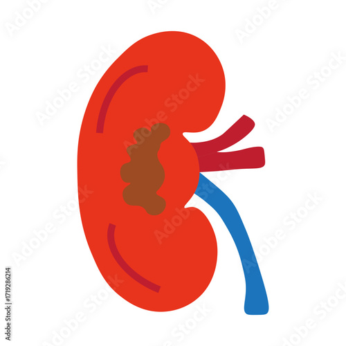 kidney cancer