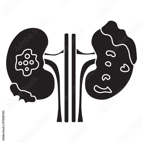 kidney cancer glyph icon