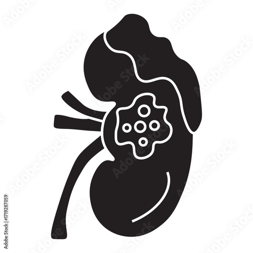 kidney cancer glyph icon