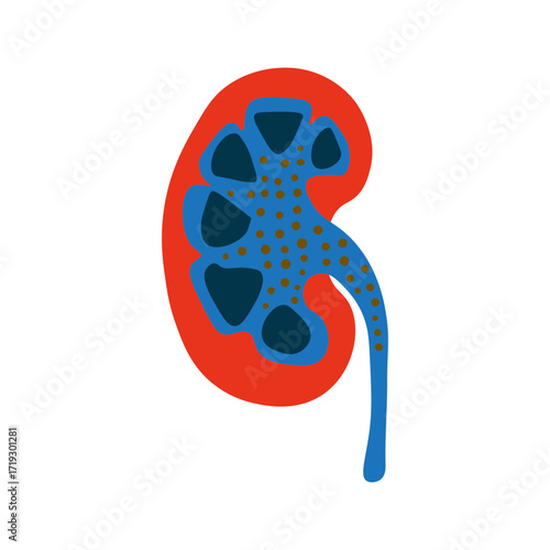 Nephrotic Syndrome