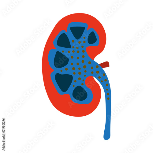 Nephrotic Syndrome