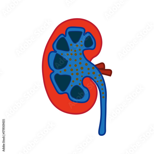Nephrotic Syndrome