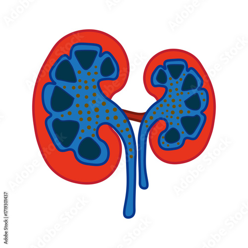 Nephrotic Syndrome
