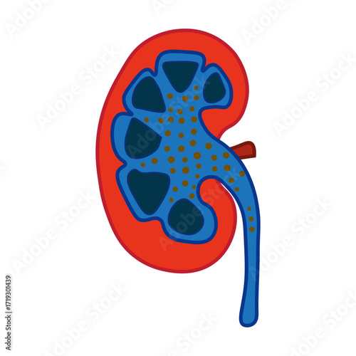 Nephrotic Syndrome