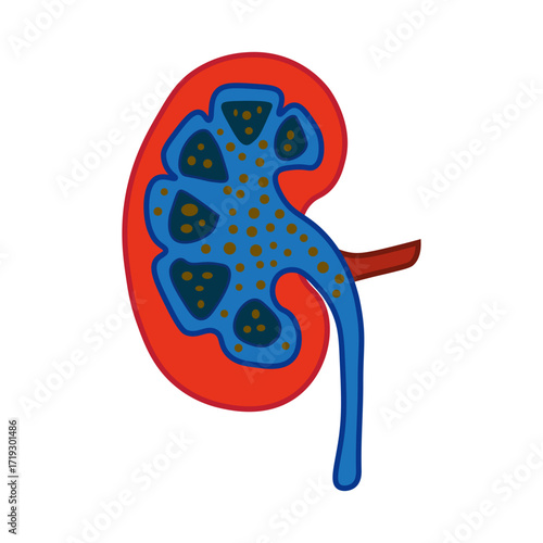 Nephrotic Syndrome