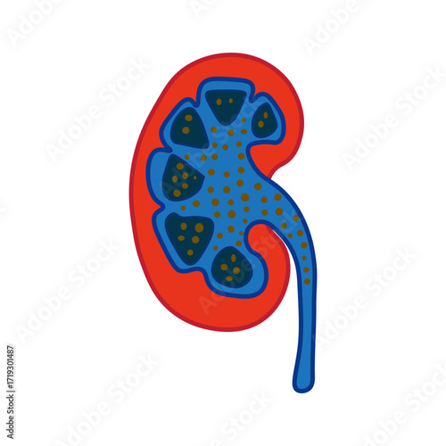 Nephrotic Syndrome