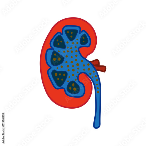Nephrotic Syndrome