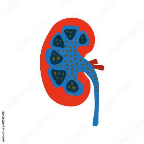 Nephrotic Syndrome
