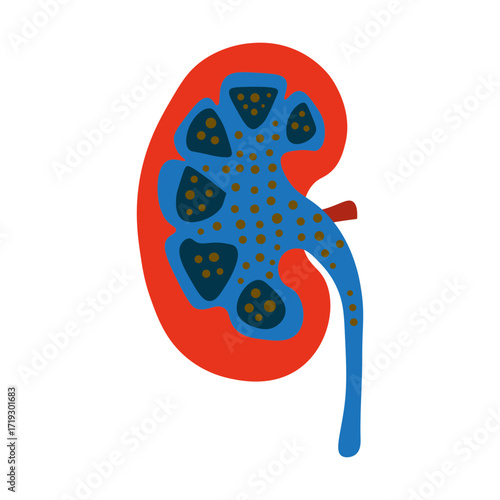 Nephrotic Syndrome