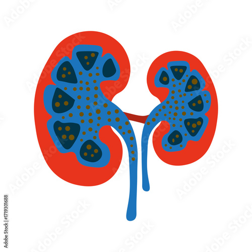 Nephrotic Syndrome