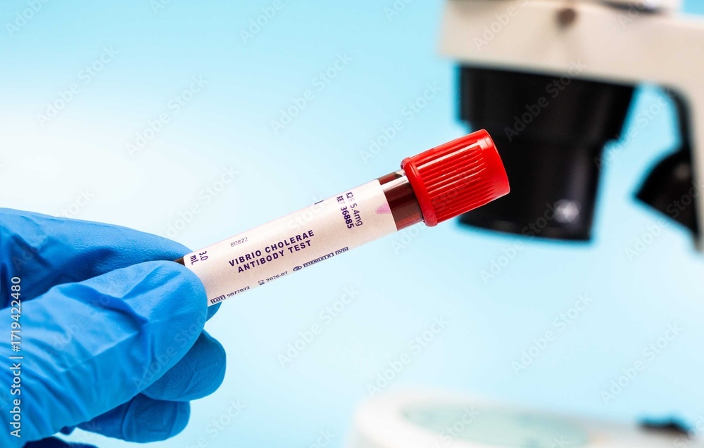 Naklejka premium Identifies antibodies to Vibrio cholerae, indicating