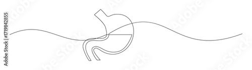 Sleeve Gastrectomy Illustration Line Art
