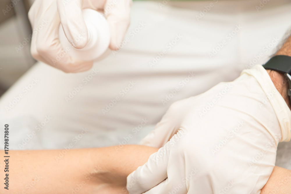 Fototapeta premium Close-up of a physiotherapist's hands expertly using an ultrasound transducer to treat a patient.