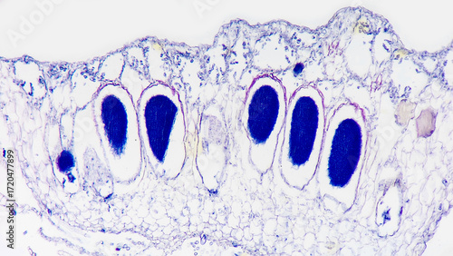 Longitudinal section of Marchantia sp. antheridial head (antheridiophore) showing antheridium (dark blue)