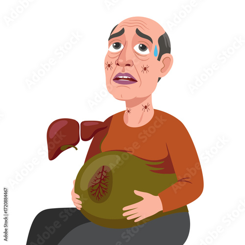 Worried man holding swollen abdomen with spider angiomas and damaged liver, illustrating cirrhosis and liver disease symptoms for medical awareness campaigns