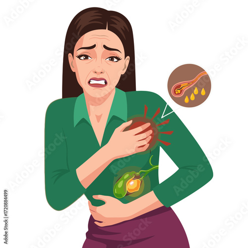 Woman experiencing agonizing gallbladder pain with diagram illustrating gallstones blocking bile flow, ideal for medical education and healthcare marketing materials