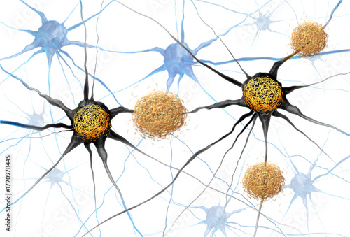 Amyloid Beta And Tau tangles concept as abnormal clusters of protein fragments that accumulate between nerve cells and inside neuron cells in the brain resulting in degenerative disease as Alzheimers.