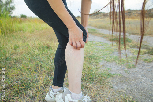 Young girl scratching foot in nature. Seasonal allergy