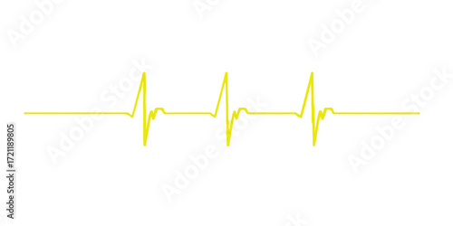 Green line ECG cardiogram showing a heartbeat pulse wave on a medical monitor graph