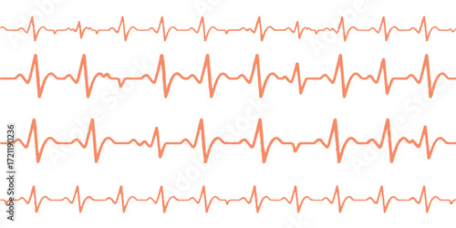 Green EKG line graph showing a heartbeat rhythm on a medical monitor trace for **