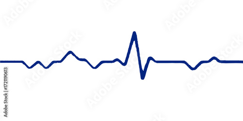 Electrocardiogram (ECG) monitor showing a green heartbeat wave on a graph