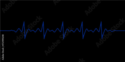 Medical vector illustration of a rhythmic heartbeat on a digital cardiogram monitor