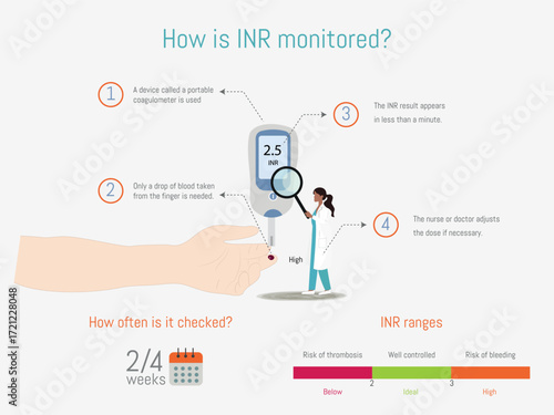 Monitoring international normalized ratio - inr - levels for anticoagulant treatment