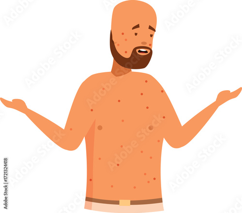 Man suffering from chickenpox symptoms, showing his body rash with open arms