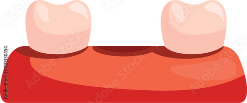 Two healthy teeth attached to gums representing a dental implant