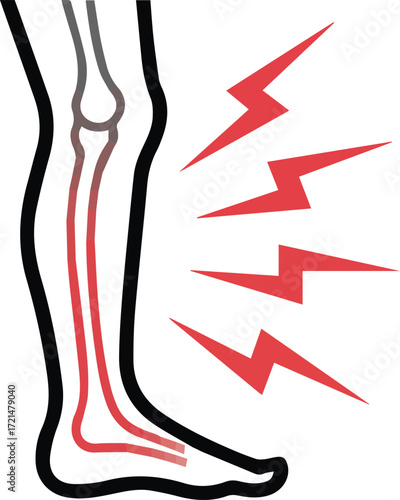Vector art of leg pain illustration representing medical condition