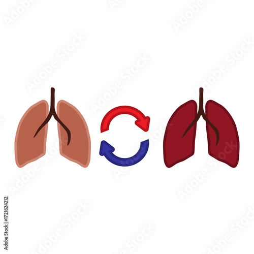 Lung Transplant