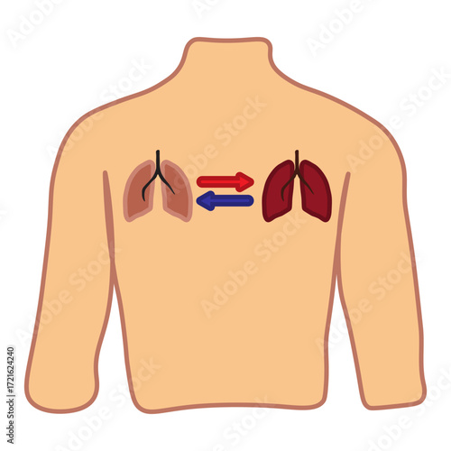 Lung Transplant