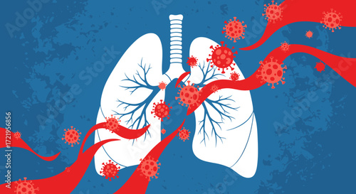 Illustration of lungs being attacked by airborne virus particles and red streaks representing infection.