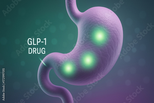 Medical illustration showing glp 1 drug effect on stomach with highlighted areas suggesting weight loss and possible side effect awareness in patient education