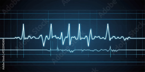 Green medical cardiogram graph showing a healthy pulse and heart rate on a monitor