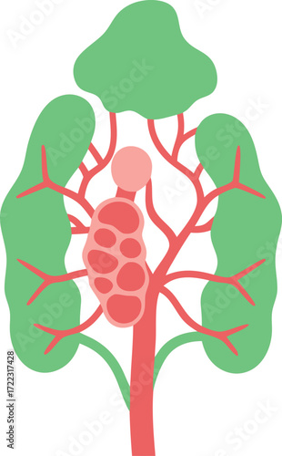 A medical illustration of a lymph node, showing its internal structure, afferent and efferent vessels, capsule, and surrounding tissue
