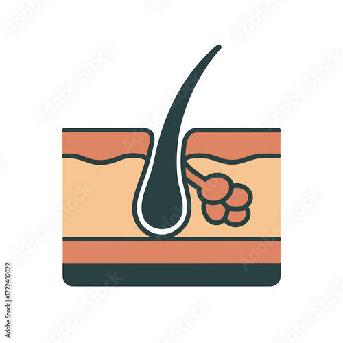 Sebaceous gland illustration showing skin layer and hair follicle  