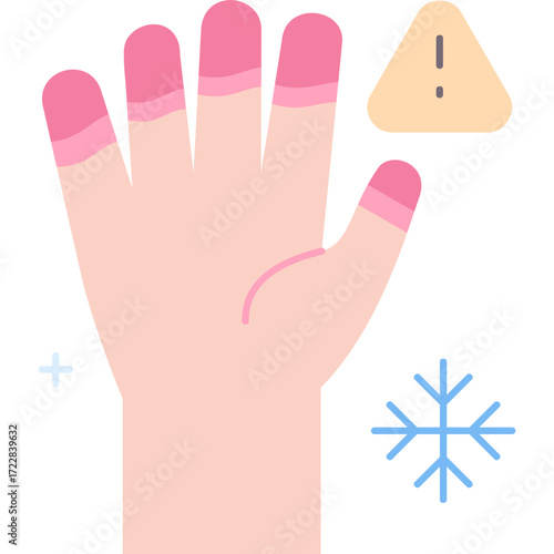 Frostbite Illustration